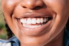 Teeth whitening: Original