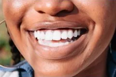 Teeth whitening: Teeth 100